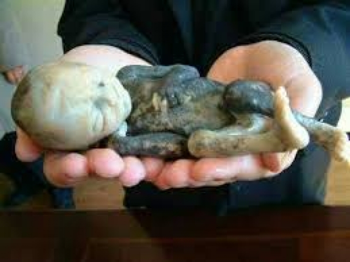 A baby killed by saline-injection abortion.  (Priests for Life) 