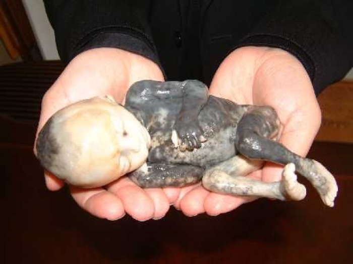 A baby killed by saline-injection abortion.  (Priests for Life)