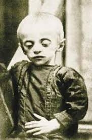 A young Holodomor victim. (Screenshot)