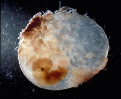 Featured is a human embryo enclosed in the amniotic sac during the fifth week of development. (Photo credit: Leemage/Contributor/Art Images via Getty Images)